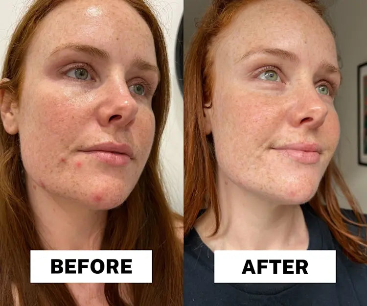 Kit de exfoliación Radiant Glow Duo™