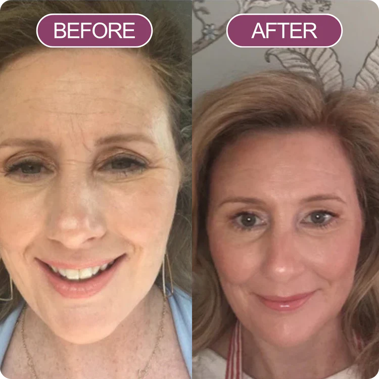 "Uncover Your Youthful Radiance Today!"